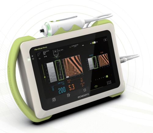 回波肝功能剪切波量化超声诊断仪FibroScanHANDY