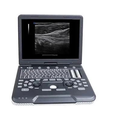 全数字彩色多普勒超声诊断系统Apogee 1000厂家